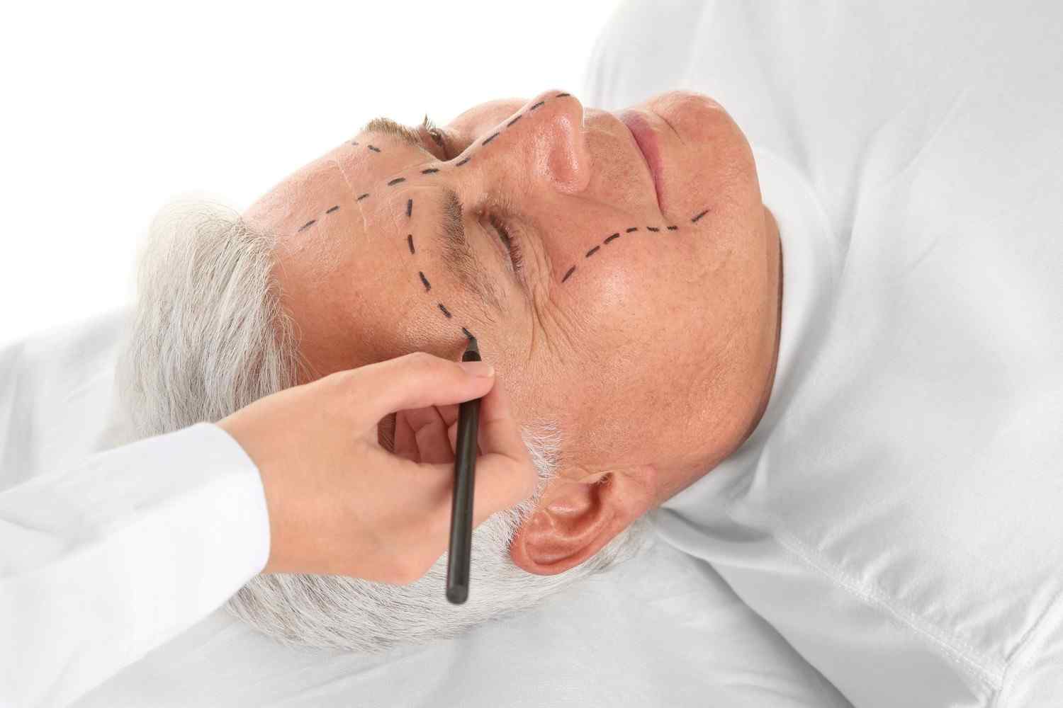 https://thermage-vietnam.com/wp-content/uploads/2017/08/cosmetic-surgery-blog-03.jpg