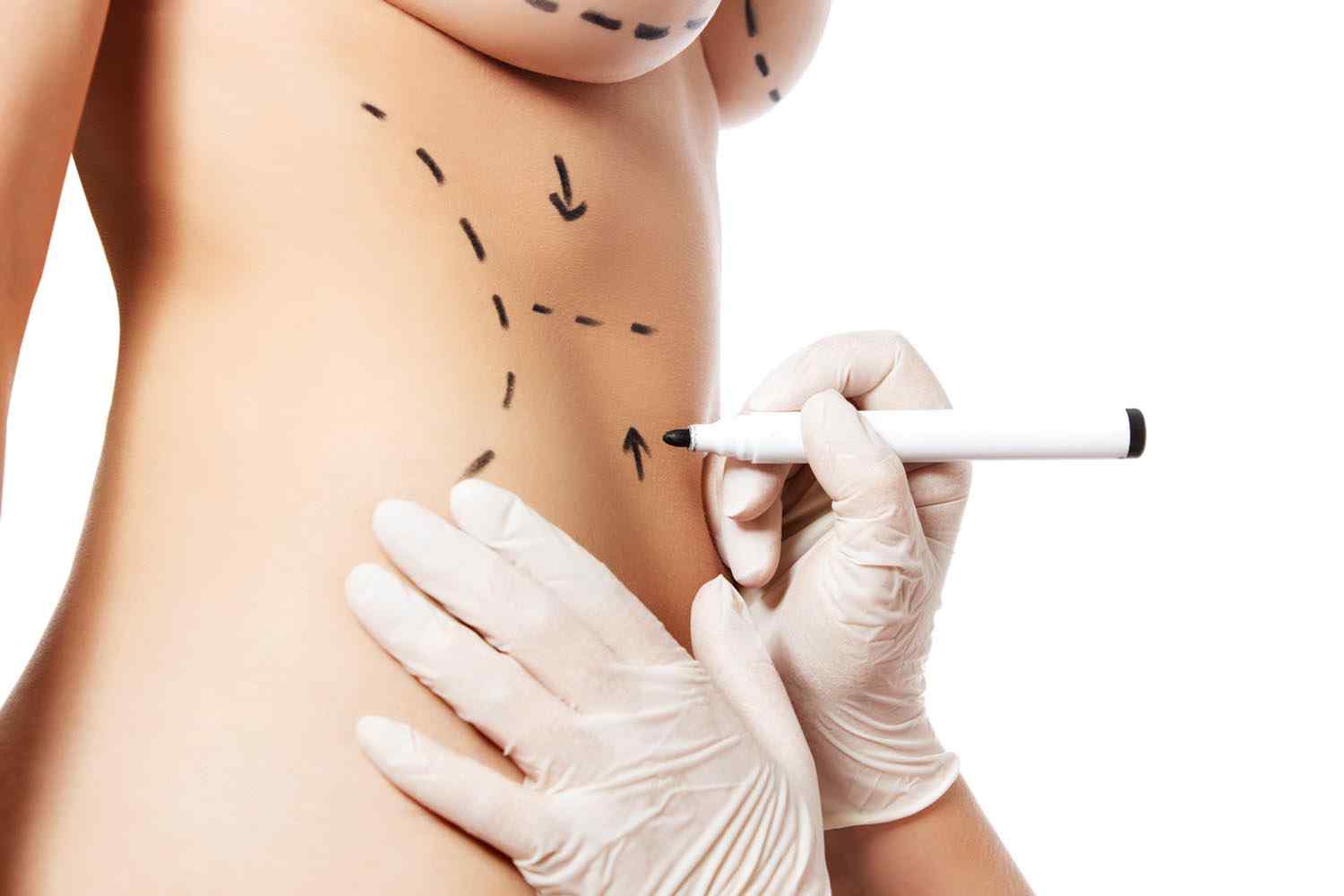 https://thermage-vietnam.com/wp-content/uploads/2017/08/cosmetic-surgery-blog-11.jpg
