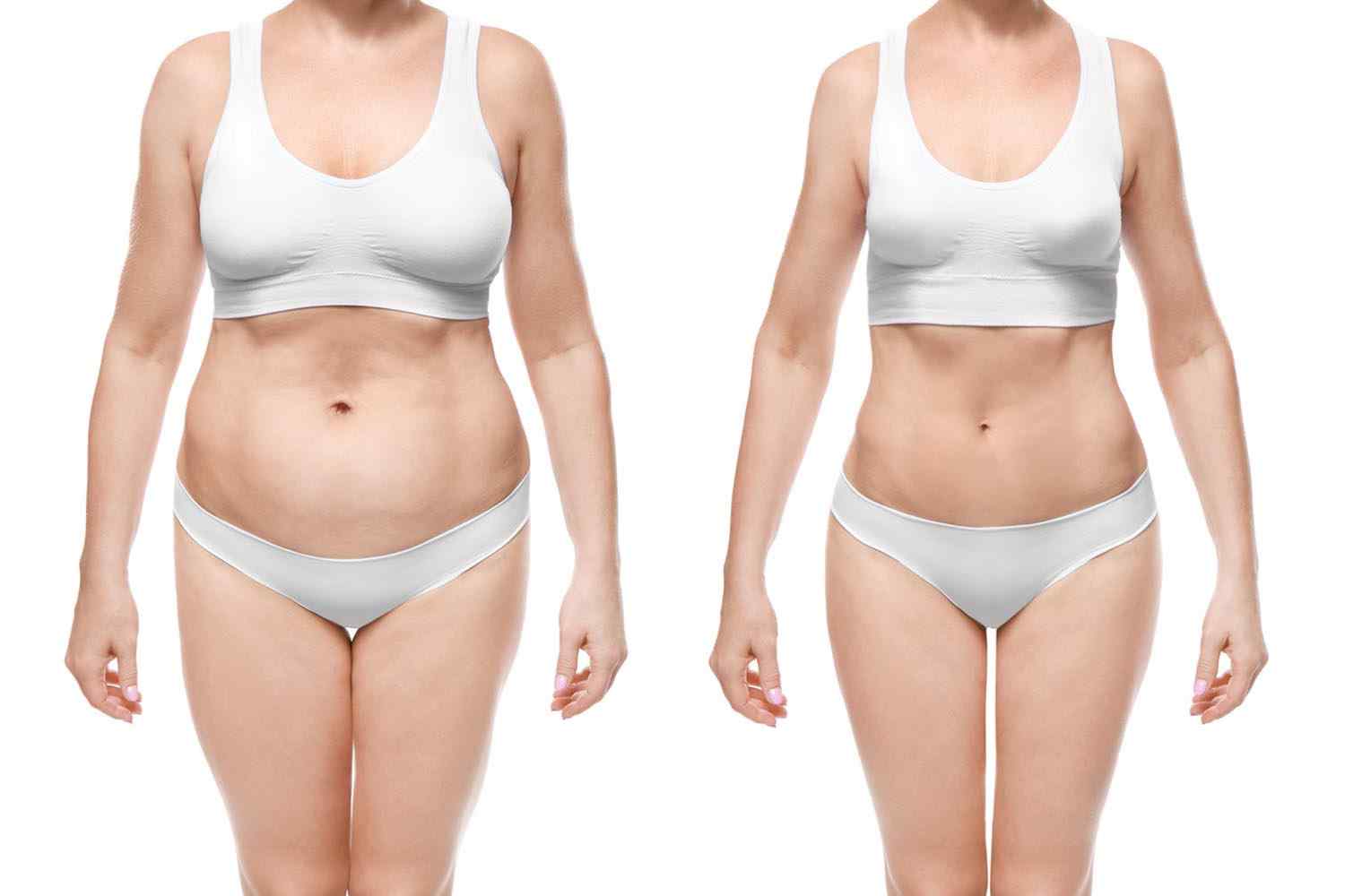 https://thermage-vietnam.com/wp-content/uploads/2017/08/cosmetic-surgery-blog-24.jpg